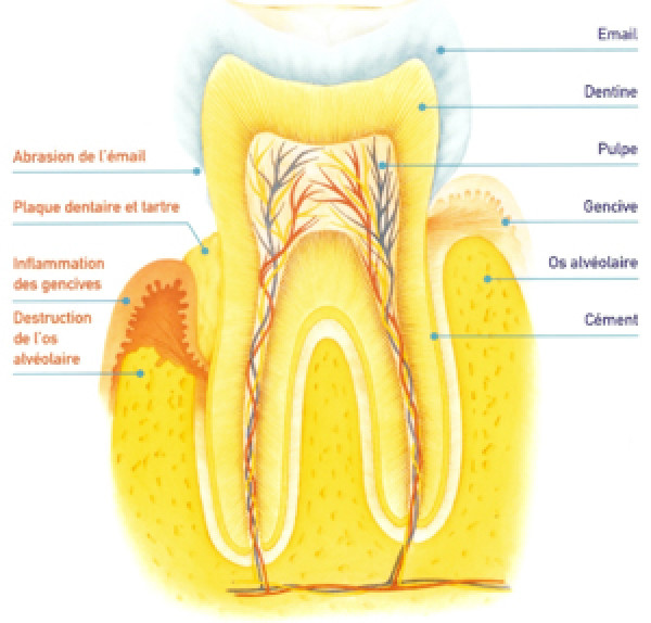 Explication du suivi hygiène pour traitement parodontal
